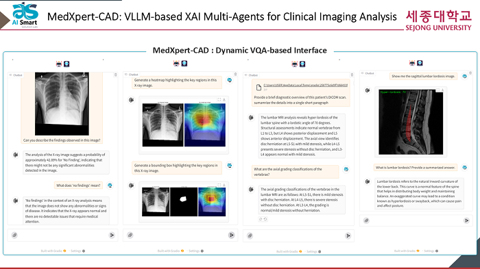 AI-Powered Clinical Image Analysis System 'MedXpert-CAD' Featured in Sejong University Newsletter